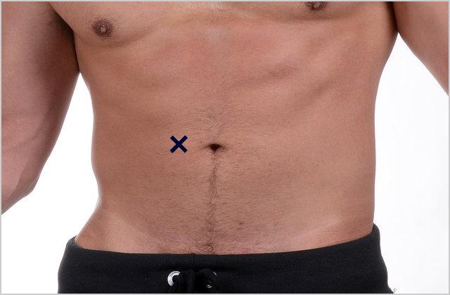 Abdominal Body Fat Skinfold