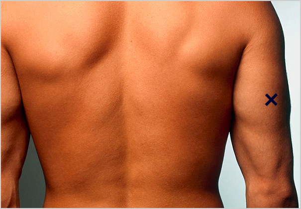 3 point body fat calculator 3 point body fat calculator